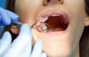 Wisdom Tooth Extraction Treatment