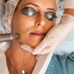 Renew Your Skin: Laser Skin Resurfacing Treatments